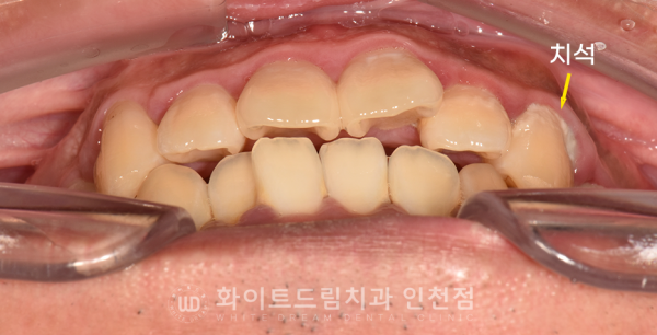3ffbb1a4512d625d6a5c3ed3e6b85b5b_1742377571_0065.png